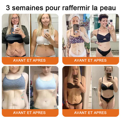 "Fabriqué et expédié de France|🐝Boutique officielle✨Purelora® venin d'abeille Crème réparatrice au 🔥 DERNIER JOUR - 80 % DE RÉDUCTION 💎"