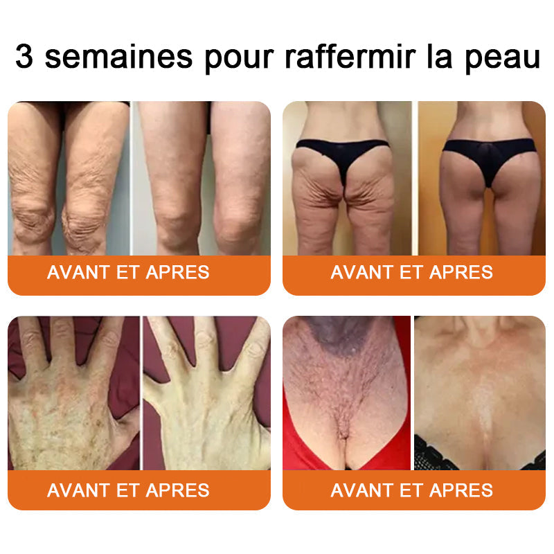 "Fabriqué et expédié de France|🐝Boutique officielle✨Purelora® venin d'abeille Crème réparatrice au 🔥 DERNIER JOUR - 80 % DE RÉDUCTION 💎"
