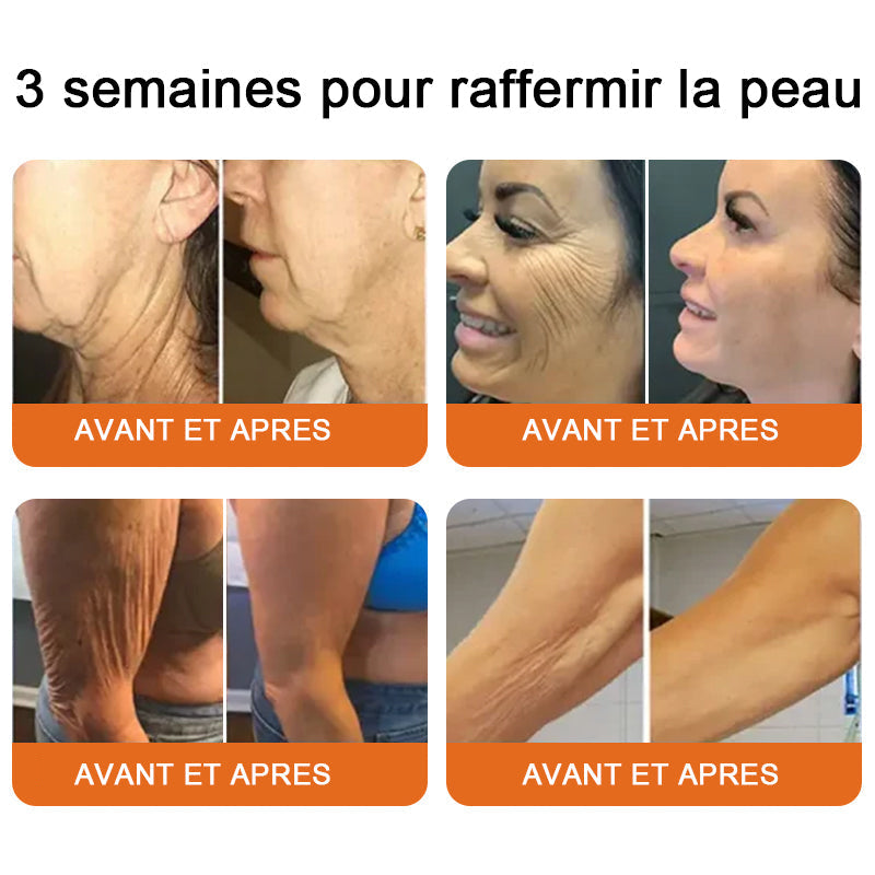 "Fabriqué et expédié de France|🐝Boutique officielle✨Purelora® venin d'abeille Crème réparatrice au 🔥 DERNIER JOUR - 80 % DE RÉDUCTION 💎"