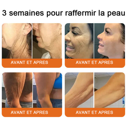 "Fabriqué et expédié de France|🐝Boutique officielle✨Purelora® venin d'abeille Crème réparatrice au 🔥 DERNIER JOUR - 80 % DE RÉDUCTION 💎"