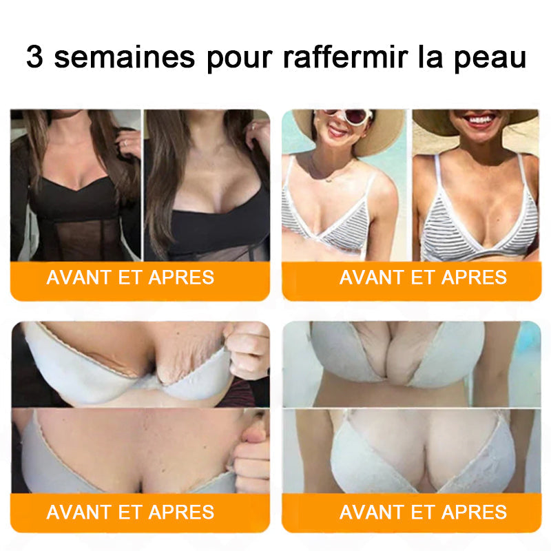 "Fabriqué et expédié de France|🐝Boutique officielle✨Purelora® venin d'abeille Crème réparatrice au 🔥 DERNIER JOUR - 80 % DE RÉDUCTION 💎"