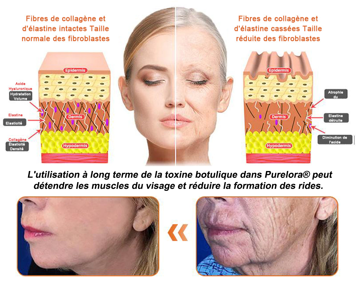 "Fabriqué et expédié de France|🐝Boutique officielle✨Purelora® venin d'abeille Crème réparatrice au 🔥 DERNIER JOUR - 80 % DE RÉDUCTION 💎"