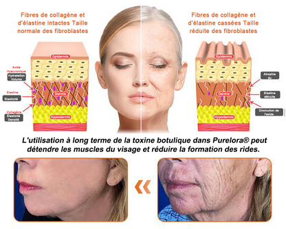 "Fabriqué et expédié de France|🐝Boutique officielle✨Purelora® venin d'abeille Crème réparatrice au 🔥 DERNIER JOUR - 80 % DE RÉDUCTION 💎"