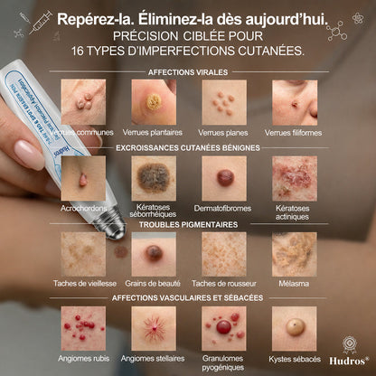 Boutique officielle de la marque | Hudros® 7 Jours Effaceur de taches et d’excroissances cutanées(Zéro douleur, zéro cicatrice – Roller)👍