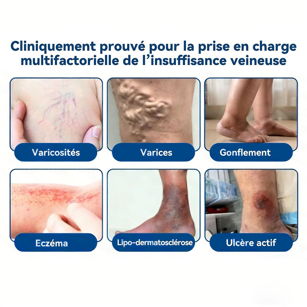 𝐏𝐮𝐫𝐞𝐥𝐨𝐫𝐚® 𝐏𝐚𝐭𝐜𝐡 𝐌𝐢𝐜𝐫𝐨-𝐀𝐢𝐠𝐮𝐢𝐥𝐥𝐞𝐬 𝐂𝐨𝐧𝐭𝐨𝐮𝐫 𝐝𝐞𝐬 𝐕𝐞𝐢𝐧𝐞𝐬 𝐚𝐮 𝐃𝐢𝐨𝐬𝐦𝐢𝐧𝐞 & 𝐀𝐞𝐬𝐜𝐢𝐧𝐞 🌿𝐑é𝐬𝐮𝐥𝐭𝐚𝐭𝐬 𝐯𝐢𝐬𝐢𝐛𝐥𝐞𝐬 𝐜𝐨𝐧𝐭𝐫𝐞 𝐥𝐞𝐬 𝐯𝐚𝐫𝐢𝐜𝐞𝐬 𝐞𝐧 𝟕 𝐣𝐨𝐮𝐫𝐬 – 𝐅𝐨𝐫𝐦𝐮𝐥𝐞 𝐯é𝐠é𝐭𝐚𝐥𝐞 𝐚𝐯𝐚𝐧𝐜é𝐞 𝐜𝐢𝐛𝐥𝐚𝐧𝐭 𝐥𝐞𝐬 𝐯𝐚𝐫𝐢𝐜𝐨𝐬𝐢𝐭é𝐬 𝐞𝐭 𝐬𝐨𝐮𝐥𝐚𝐠𝐞𝐚𝐧𝐭 𝐥𝐞𝐬 𝐣𝐚𝐦𝐛𝐞𝐬 𝐥𝐨𝐮𝐫𝐝𝐞𝐬 𝐞𝐭 𝐟𝐚𝐭𝐢𝐠𝐮é𝐞𝐬