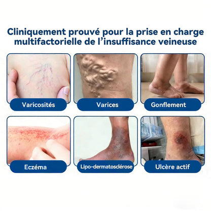 𝐏𝐮𝐫𝐞𝐥𝐨𝐫𝐚® 𝐏𝐚𝐭𝐜𝐡 𝐌𝐢𝐜𝐫𝐨-𝐀𝐢𝐠𝐮𝐢𝐥𝐥𝐞𝐬 𝐂𝐨𝐧𝐭𝐨𝐮𝐫 𝐝𝐞𝐬 𝐕𝐞𝐢𝐧𝐞𝐬 𝐚𝐮 𝐃𝐢𝐨𝐬𝐦𝐢𝐧𝐞 & 𝐀𝐞𝐬𝐜𝐢𝐧𝐞 🌿𝐑é𝐬𝐮𝐥𝐭𝐚𝐭𝐬 𝐯𝐢𝐬𝐢𝐛𝐥𝐞𝐬 𝐜𝐨𝐧𝐭𝐫𝐞 𝐥𝐞𝐬 𝐯𝐚𝐫𝐢𝐜𝐞𝐬 𝐞𝐧 𝟕 𝐣𝐨𝐮𝐫𝐬 – 𝐅𝐨𝐫𝐦𝐮𝐥𝐞 𝐯é𝐠é𝐭𝐚𝐥𝐞 𝐚𝐯𝐚𝐧𝐜é𝐞 𝐜𝐢𝐛𝐥𝐚𝐧𝐭 𝐥𝐞𝐬 𝐯𝐚𝐫𝐢𝐜𝐨𝐬𝐢𝐭é𝐬 𝐞𝐭 𝐬𝐨𝐮𝐥𝐚𝐠𝐞𝐚𝐧𝐭 𝐥𝐞𝐬 𝐣𝐚𝐦𝐛𝐞𝐬 𝐥𝐨𝐮𝐫𝐝𝐞𝐬 𝐞𝐭 𝐟𝐚𝐭𝐢𝐠𝐮é𝐞𝐬