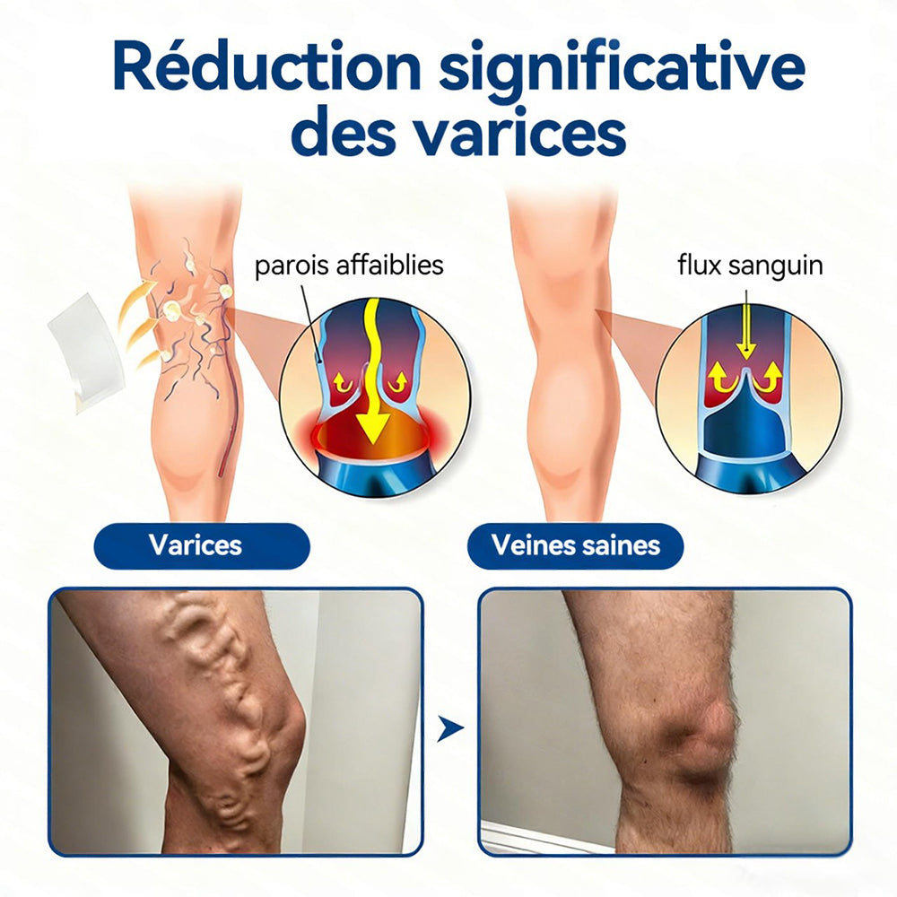 𝐏𝐮𝐫𝐞𝐥𝐨𝐫𝐚® 𝐏𝐚𝐭𝐜𝐡 𝐌𝐢𝐜𝐫𝐨-𝐀𝐢𝐠𝐮𝐢𝐥𝐥𝐞𝐬 𝐂𝐨𝐧𝐭𝐨𝐮𝐫 𝐝𝐞𝐬 𝐕𝐞𝐢𝐧𝐞𝐬 𝐚𝐮 𝐃𝐢𝐨𝐬𝐦𝐢𝐧𝐞 & 𝐀𝐞𝐬𝐜𝐢𝐧𝐞 🌿𝐑é𝐬𝐮𝐥𝐭𝐚𝐭𝐬 𝐯𝐢𝐬𝐢𝐛𝐥𝐞𝐬 𝐜𝐨𝐧𝐭𝐫𝐞 𝐥𝐞𝐬 𝐯𝐚𝐫𝐢𝐜𝐞𝐬 𝐞𝐧 𝟕 𝐣𝐨𝐮𝐫𝐬 – 𝐅𝐨𝐫𝐦𝐮𝐥𝐞 𝐯é𝐠é𝐭𝐚𝐥𝐞 𝐚𝐯𝐚𝐧𝐜é𝐞 𝐜𝐢𝐛𝐥𝐚𝐧𝐭 𝐥𝐞𝐬 𝐯𝐚𝐫𝐢𝐜𝐨𝐬𝐢𝐭é𝐬 𝐞𝐭 𝐬𝐨𝐮𝐥𝐚𝐠𝐞𝐚𝐧𝐭 𝐥𝐞𝐬 𝐣𝐚𝐦𝐛𝐞𝐬 𝐥𝐨𝐮𝐫𝐝𝐞𝐬 𝐞𝐭 𝐟𝐚𝐭𝐢𝐠𝐮é𝐞𝐬