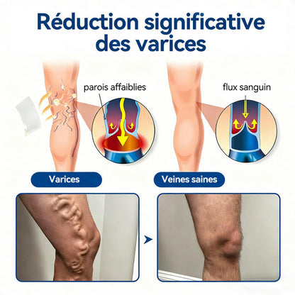 𝐏𝐮𝐫𝐞𝐥𝐨𝐫𝐚® 𝐏𝐚𝐭𝐜𝐡 𝐌𝐢𝐜𝐫𝐨-𝐀𝐢𝐠𝐮𝐢𝐥𝐥𝐞𝐬 𝐂𝐨𝐧𝐭𝐨𝐮𝐫 𝐝𝐞𝐬 𝐕𝐞𝐢𝐧𝐞𝐬 𝐚𝐮 𝐃𝐢𝐨𝐬𝐦𝐢𝐧𝐞 & 𝐀𝐞𝐬𝐜𝐢𝐧𝐞 🌿𝐑é𝐬𝐮𝐥𝐭𝐚𝐭𝐬 𝐯𝐢𝐬𝐢𝐛𝐥𝐞𝐬 𝐜𝐨𝐧𝐭𝐫𝐞 𝐥𝐞𝐬 𝐯𝐚𝐫𝐢𝐜𝐞𝐬 𝐞𝐧 𝟕 𝐣𝐨𝐮𝐫𝐬 – 𝐅𝐨𝐫𝐦𝐮𝐥𝐞 𝐯é𝐠é𝐭𝐚𝐥𝐞 𝐚𝐯𝐚𝐧𝐜é𝐞 𝐜𝐢𝐛𝐥𝐚𝐧𝐭 𝐥𝐞𝐬 𝐯𝐚𝐫𝐢𝐜𝐨𝐬𝐢𝐭é𝐬 𝐞𝐭 𝐬𝐨𝐮𝐥𝐚𝐠𝐞𝐚𝐧𝐭 𝐥𝐞𝐬 𝐣𝐚𝐦𝐛𝐞𝐬 𝐥𝐨𝐮𝐫𝐝𝐞𝐬 𝐞𝐭 𝐟𝐚𝐭𝐢𝐠𝐮é𝐞𝐬