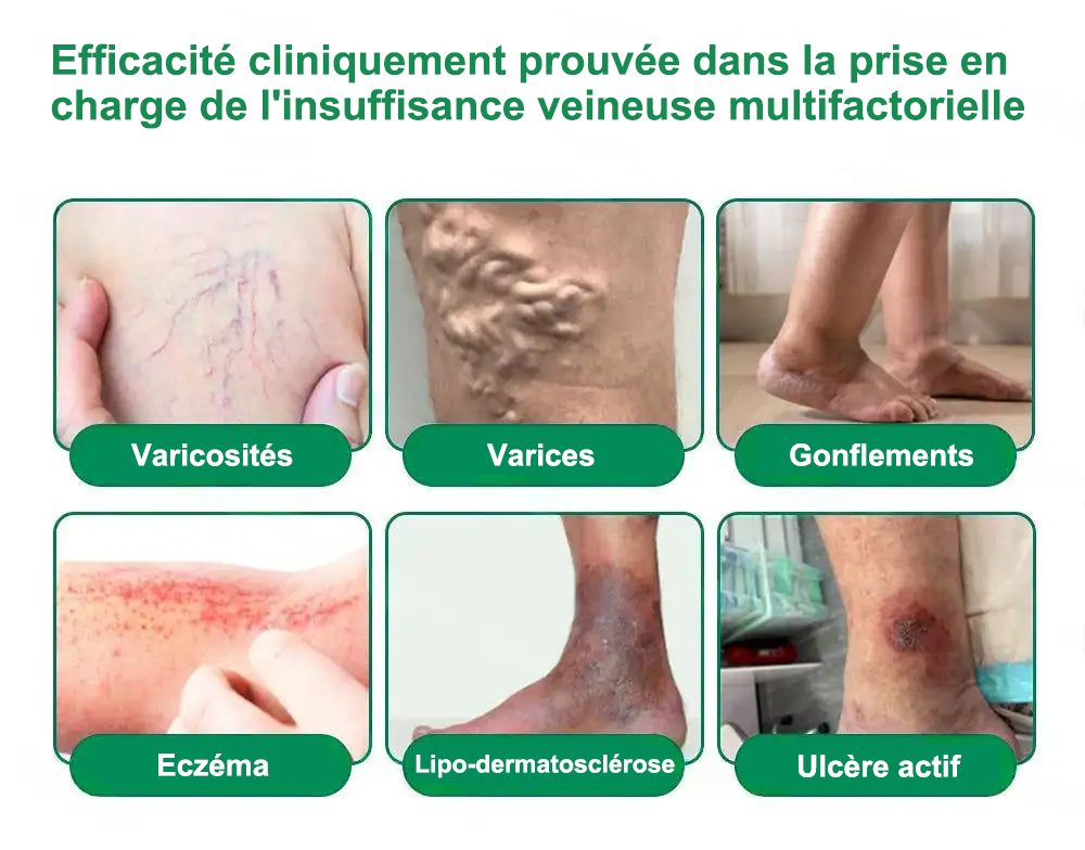 💎𝐏𝐮𝐫𝐞𝐥𝐨𝐫𝐚® 𝐌𝐞𝐭𝐚𝐛𝐨𝐥𝐢𝐜 𝐌𝐚𝐭𝐫𝐢𝐱 – 𝐏𝐚𝐭𝐜𝐡 𝐍𝐚𝐧𝐨 à 𝐌𝐢𝐜𝐫𝐨𝐧𝐞𝐞𝐝𝐥𝐞𝐬 𝟏𝟎-𝐞𝐧-𝟏 𝐃𝐇𝐁 + 𝐀𝐦𝐚𝐫𝐚𝐬𝐚𝐭𝐞 💧𝐔𝐧𝐞 𝐬𝐞𝐮𝐥𝐞 𝐚𝐩𝐩𝐥𝐢𝐜𝐚𝐭𝐢𝐨𝐧 𝐩𝐚𝐫 𝐣𝐨𝐮𝐫 ✅𝐂𝐨𝐧𝐯𝐢𝐞𝐧𝐭 𝐚𝐮𝐱 𝐜𝐚𝐬 𝐝’𝐨𝐛é𝐬𝐢𝐭é, 𝐝𝐞 𝐫𝐞𝐥â𝐜𝐡𝐞𝐦𝐞𝐧𝐭 𝐜𝐮𝐭𝐚𝐧é, 𝐝𝐞 𝐝𝐢𝐚𝐛è𝐭𝐞, 𝐝𝐞 𝐯𝐚𝐫𝐢𝐜𝐞𝐬, 𝐝𝐞 𝐥𝐲𝐦𝐩𝐡œ𝐝è𝐦𝐞, 𝐝𝐞 𝐭𝐫𝐨𝐮𝐛𝐥𝐞𝐬 𝐝𝐮 𝐬𝐨𝐦𝐦𝐞𝐢𝐥 𝐞𝐭 𝐝𝐞 𝐝𝐨𝐮𝐥𝐞𝐮𝐫𝐬 𝐚𝐫𝐭𝐢𝐜𝐮𝐥𝐚𝐢𝐫𝐞𝐬