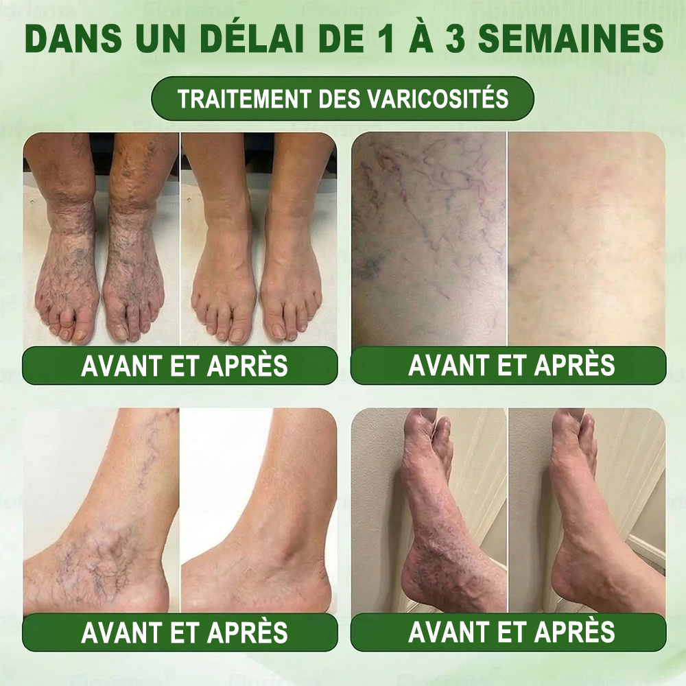 💎𝐏𝐮𝐫𝐞𝐥𝐨𝐫𝐚® 𝐌𝐞𝐭𝐚𝐛𝐨𝐥𝐢𝐜 𝐌𝐚𝐭𝐫𝐢𝐱 – 𝐏𝐚𝐭𝐜𝐡 𝐍𝐚𝐧𝐨 à 𝐌𝐢𝐜𝐫𝐨𝐧𝐞𝐞𝐝𝐥𝐞𝐬 𝟏𝟎-𝐞𝐧-𝟏 𝐃𝐇𝐁 + 𝐀𝐦𝐚𝐫𝐚𝐬𝐚𝐭𝐞 💧𝐔𝐧𝐞 𝐬𝐞𝐮𝐥𝐞 𝐚𝐩𝐩𝐥𝐢𝐜𝐚𝐭𝐢𝐨𝐧 𝐩𝐚𝐫 𝐣𝐨𝐮𝐫 ✅𝐂𝐨𝐧𝐯𝐢𝐞𝐧𝐭 𝐚𝐮𝐱 𝐜𝐚𝐬 𝐝’𝐨𝐛é𝐬𝐢𝐭é, 𝐝𝐞 𝐫𝐞𝐥â𝐜𝐡𝐞𝐦𝐞𝐧𝐭 𝐜𝐮𝐭𝐚𝐧é, 𝐝𝐞 𝐝𝐢𝐚𝐛è𝐭𝐞, 𝐝𝐞 𝐯𝐚𝐫𝐢𝐜𝐞𝐬, 𝐝𝐞 𝐥𝐲𝐦𝐩𝐡œ𝐝è𝐦𝐞, 𝐝𝐞 𝐭𝐫𝐨𝐮𝐛𝐥𝐞𝐬 𝐝𝐮 𝐬𝐨𝐦𝐦𝐞𝐢𝐥 𝐞𝐭 𝐝𝐞 𝐝𝐨𝐮𝐥𝐞𝐮𝐫𝐬 𝐚𝐫𝐭𝐢𝐜𝐮𝐥𝐚𝐢𝐫𝐞𝐬