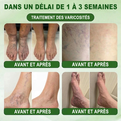 💎𝐏𝐮𝐫𝐞𝐥𝐨𝐫𝐚® 𝐌𝐞𝐭𝐚𝐛𝐨𝐥𝐢𝐜 𝐌𝐚𝐭𝐫𝐢𝐱 – 𝐏𝐚𝐭𝐜𝐡 𝐍𝐚𝐧𝐨 à 𝐌𝐢𝐜𝐫𝐨𝐧𝐞𝐞𝐝𝐥𝐞𝐬 𝟏𝟎-𝐞𝐧-𝟏 𝐃𝐇𝐁 + 𝐀𝐦𝐚𝐫𝐚𝐬𝐚𝐭𝐞 💧𝐔𝐧𝐞 𝐬𝐞𝐮𝐥𝐞 𝐚𝐩𝐩𝐥𝐢𝐜𝐚𝐭𝐢𝐨𝐧 𝐩𝐚𝐫 𝐣𝐨𝐮𝐫 ✅𝐂𝐨𝐧𝐯𝐢𝐞𝐧𝐭 𝐚𝐮𝐱 𝐜𝐚𝐬 𝐝’𝐨𝐛é𝐬𝐢𝐭é, 𝐝𝐞 𝐫𝐞𝐥â𝐜𝐡𝐞𝐦𝐞𝐧𝐭 𝐜𝐮𝐭𝐚𝐧é, 𝐝𝐞 𝐝𝐢𝐚𝐛è𝐭𝐞, 𝐝𝐞 𝐯𝐚𝐫𝐢𝐜𝐞𝐬, 𝐝𝐞 𝐥𝐲𝐦𝐩𝐡œ𝐝è𝐦𝐞, 𝐝𝐞 𝐭𝐫𝐨𝐮𝐛𝐥𝐞𝐬 𝐝𝐮 𝐬𝐨𝐦𝐦𝐞𝐢𝐥 𝐞𝐭 𝐝𝐞 𝐝𝐨𝐮𝐥𝐞𝐮𝐫𝐬 𝐚𝐫𝐭𝐢𝐜𝐮𝐥𝐚𝐢𝐫𝐞𝐬