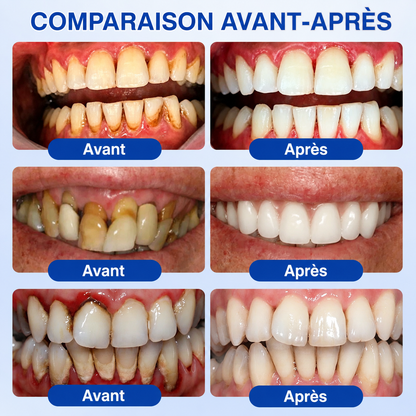 💎𝑷𝒖𝒓𝒆𝒍𝒐𝒓𝒂® 𝑮𝒖𝒎𝑹𝒆𝒗𝒊𝒗𝒆 𝑮𝒆𝒍 𝒅𝒆 𝑹é𝒑𝒂𝒓𝒂𝒕𝒊𝒐𝒏 𝑷𝒂𝒓𝒐𝒅𝒐𝒏𝒕𝒂𝒍𝒆