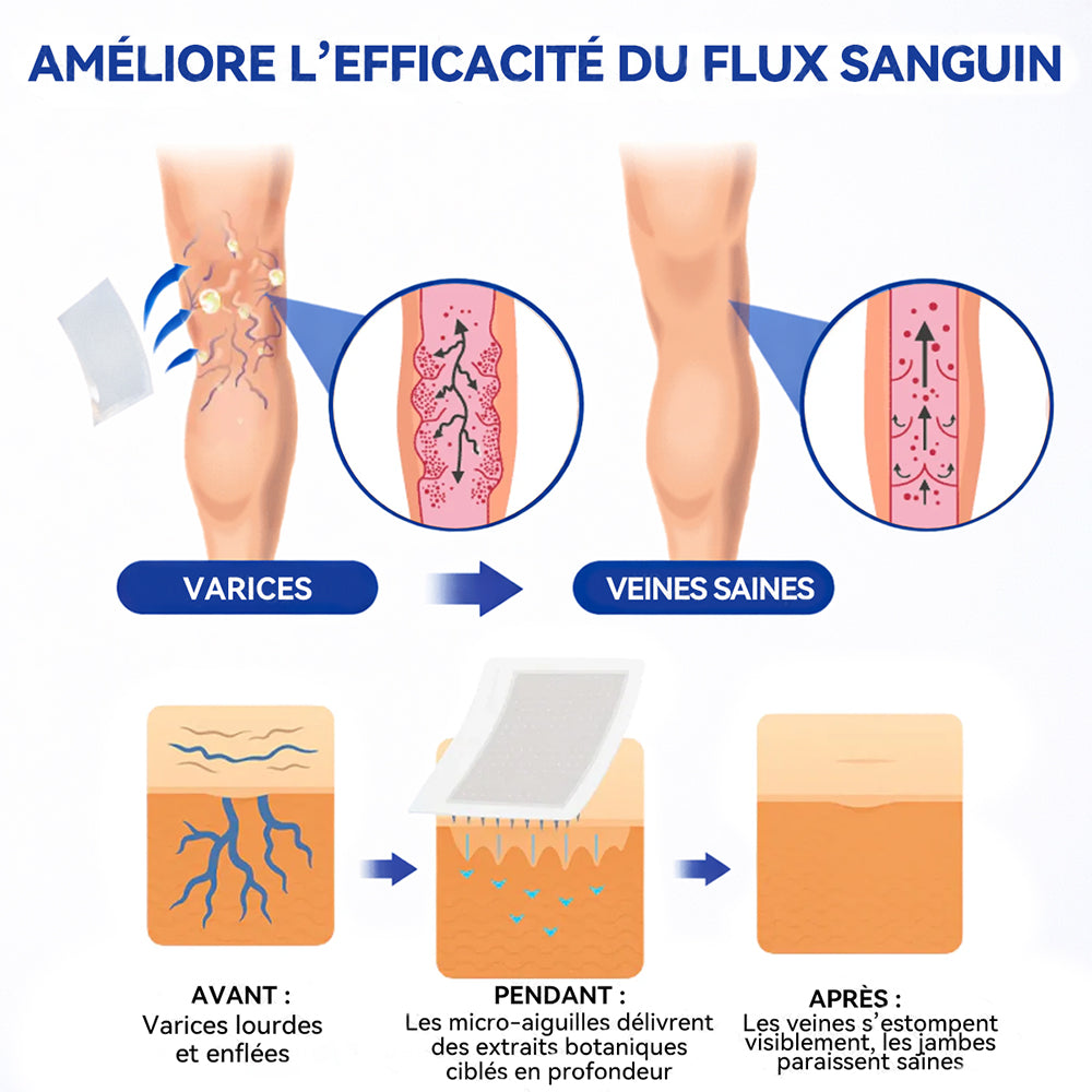 𝐏𝐮𝐫𝐞𝐥𝐨𝐫𝐚® 𝐏𝐚𝐭𝐜𝐡 𝐌𝐢𝐜𝐫𝐨-𝐀𝐢𝐠𝐮𝐢𝐥𝐥𝐞𝐬 𝐂𝐨𝐧𝐭𝐨𝐮𝐫 𝐝𝐞𝐬 𝐕𝐞𝐢𝐧𝐞𝐬 𝐚𝐮 𝐃𝐢𝐨𝐬𝐦𝐢𝐧𝐞 & 𝐀𝐞𝐬𝐜𝐢𝐧𝐞 🌿𝐑é𝐬𝐮𝐥𝐭𝐚𝐭𝐬 𝐯𝐢𝐬𝐢𝐛𝐥𝐞𝐬 𝐜𝐨𝐧𝐭𝐫𝐞 𝐥𝐞𝐬 𝐯𝐚𝐫𝐢𝐜𝐞𝐬 𝐞𝐧 𝟕 𝐣𝐨𝐮𝐫𝐬 – 𝐅𝐨𝐫𝐦𝐮𝐥𝐞 𝐯é𝐠é𝐭𝐚𝐥𝐞 𝐚𝐯𝐚𝐧𝐜é𝐞 𝐜𝐢𝐛𝐥𝐚𝐧𝐭 𝐥𝐞𝐬 𝐯𝐚𝐫𝐢𝐜𝐨𝐬𝐢𝐭é𝐬 𝐞𝐭 𝐬𝐨𝐮𝐥𝐚𝐠𝐞𝐚𝐧𝐭 𝐥𝐞𝐬 𝐣𝐚𝐦𝐛𝐞𝐬 𝐥𝐨𝐮𝐫𝐝𝐞𝐬 𝐞𝐭 𝐟𝐚𝐭𝐢𝐠𝐮é𝐞𝐬