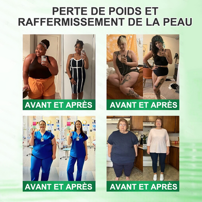 🇫🇷 Boutique Officielle France | 🌷🔥 𝗖𝘂𝗿𝗮𝗹𝗼𝗻𝗮® Berbérine · Moringa × NAD+ Patch Nano Microneedle 10-en-1 Avancé  💪 Une application par jour — des résultats visibles dès 7 jours